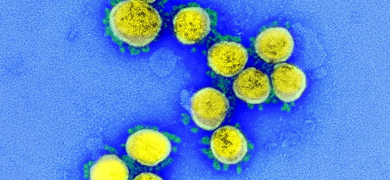 18 científicos dijeron que están bajo investigación por coronavirus desde el laboratorio